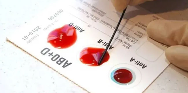 Kan grubunuza göre çarpıcı gerçek ortaya çıktı! Japon araştırmacılar uyardı