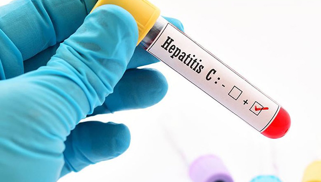 'Herkes mutlaka Hepatit C testi yaptırmalı'
