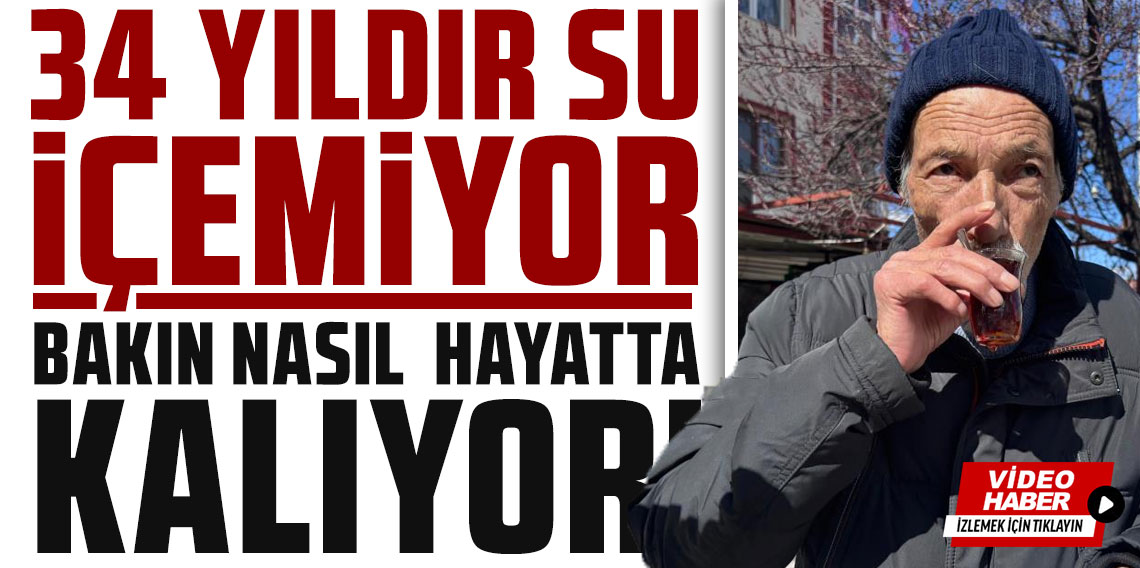34 yıldır su içemiyor, bakın nasıl hayatta kalıyor!