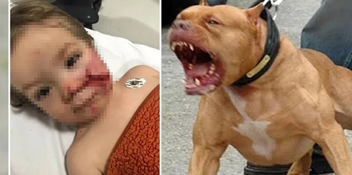 Ankara’da pitbull dehşeti