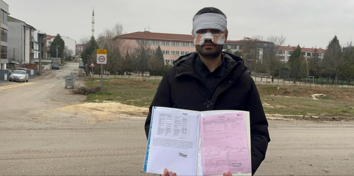 Eskişehir’de Lisede Sıcak Çaylı Saldırı İddiası