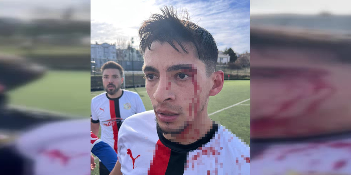 Maç sonrası saha içi savaş alanına döndü