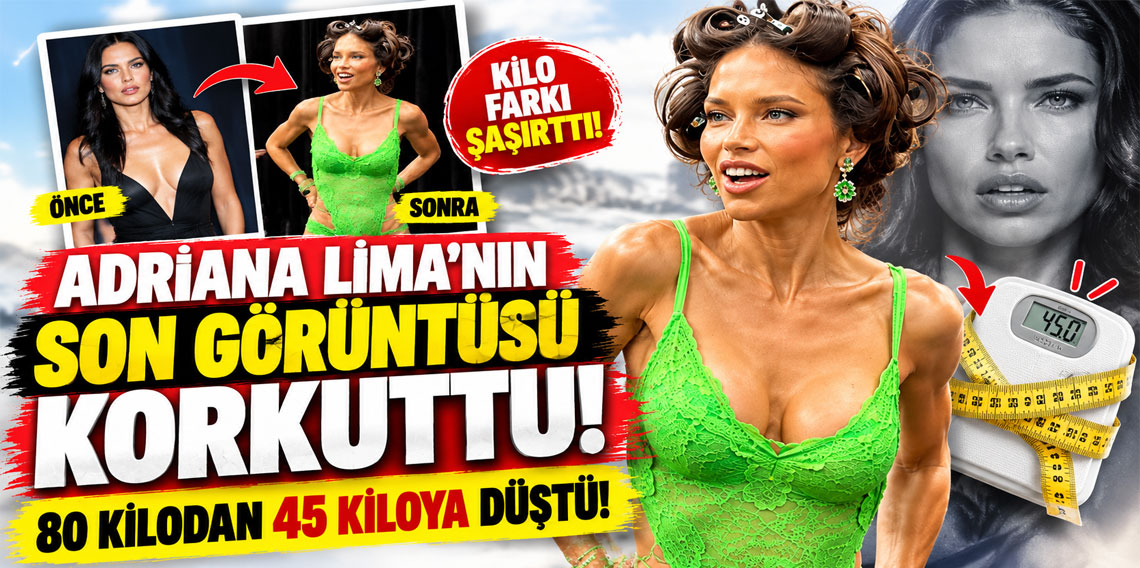 Adriana Lima’nın son görüntüsü korkuttu! 80 kilodan 45 kiloya düştü