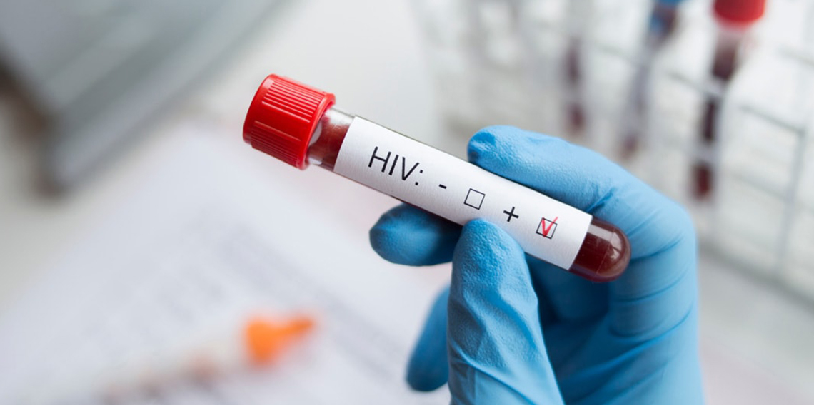 Önyargılar HIV ile yaşayan bireylerin tanı ve tedaviye ulaşmasını zorlaştırıyor