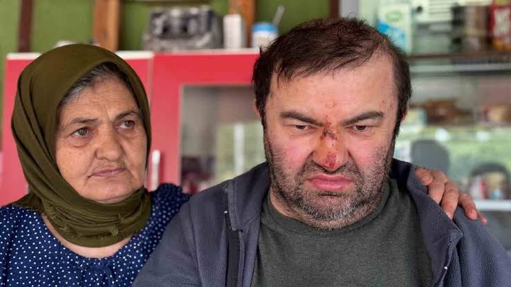 Yüzde 90 engelli vatandaş acımasızca darp edildi
