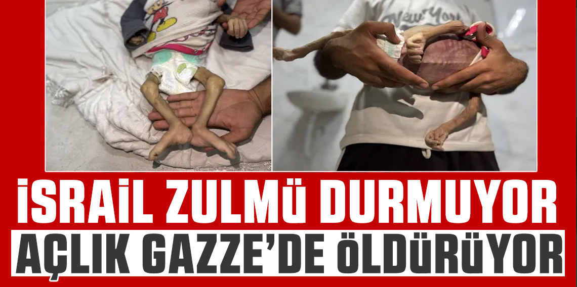 Gazze’de Açlık Felaketi