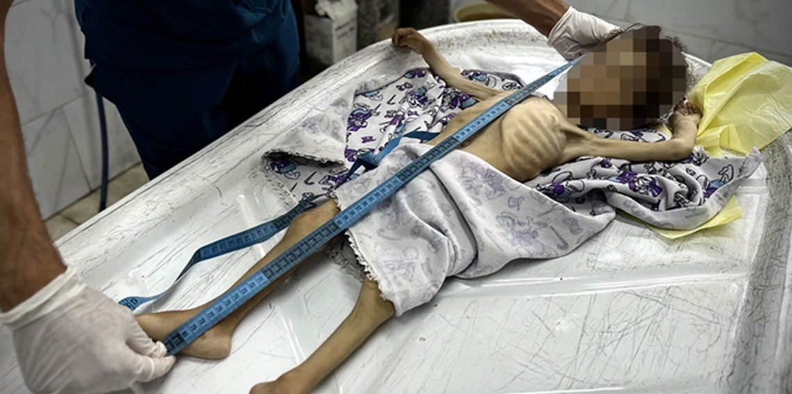 Alman Bild 'Gazze'de kıtlık yok' dedi İsrail'den övgü aldı
