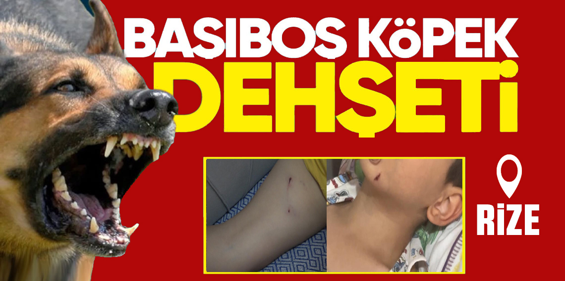 Rize’de 5 yaşındaki çocuk, sokak köpeğinin saldırısına uğradı