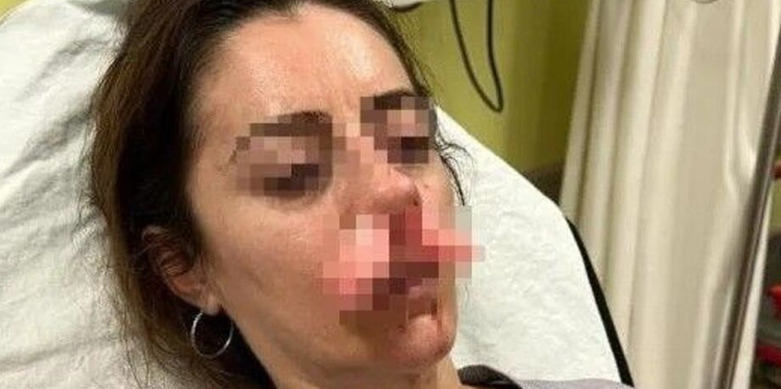 Otomobilin kapısı bu kez silah sayıldı!