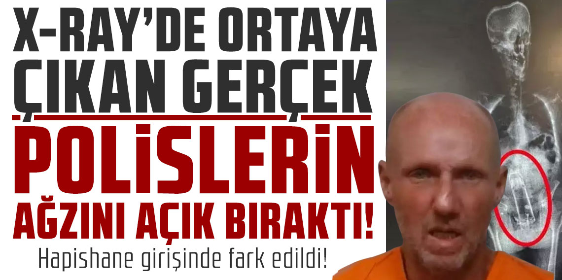 Hapishane girişinde fark edildi! X-Ray'de ortaya çıkan gerçek polislerin ağzını açık bıraktı