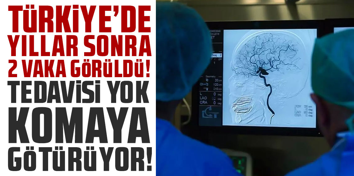 Türkiye'de yıllar sonra 2 vaka görüldü! Tedavisi yok, komaya götürüyor!