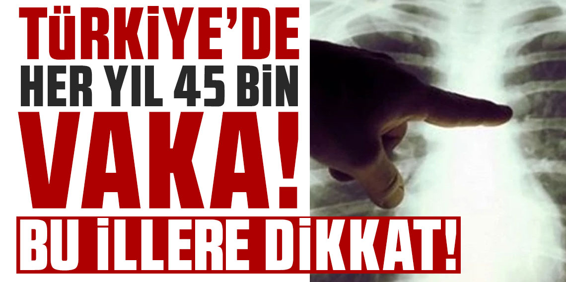 Türkiye'de her yıl 45 bin yeni vaka! Bu illere dikkat: Risk daha fazla!