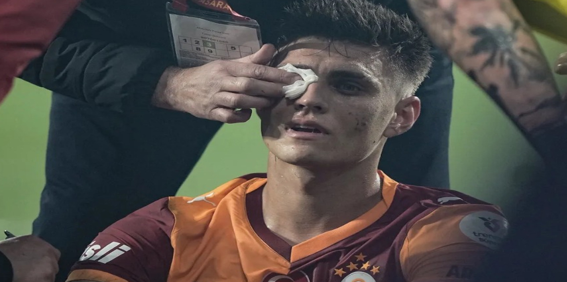 Kazımcan’ın yüzüne yabancı madde atıldı! 