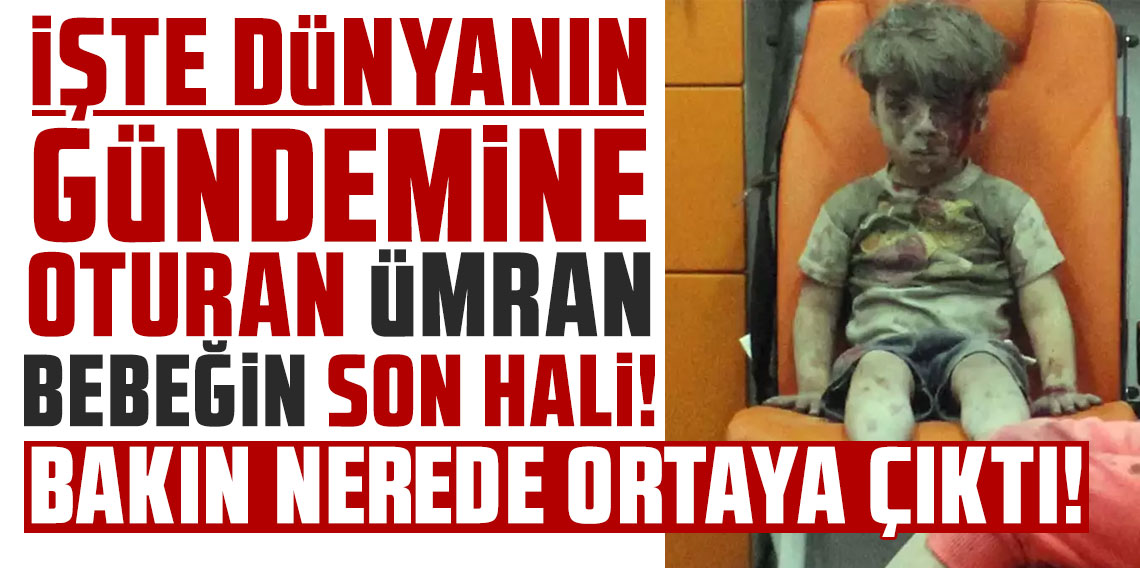 Bakın nerede ortaya çıktı: İşte dünya gündemine oturan Ümran bebeğin son hali