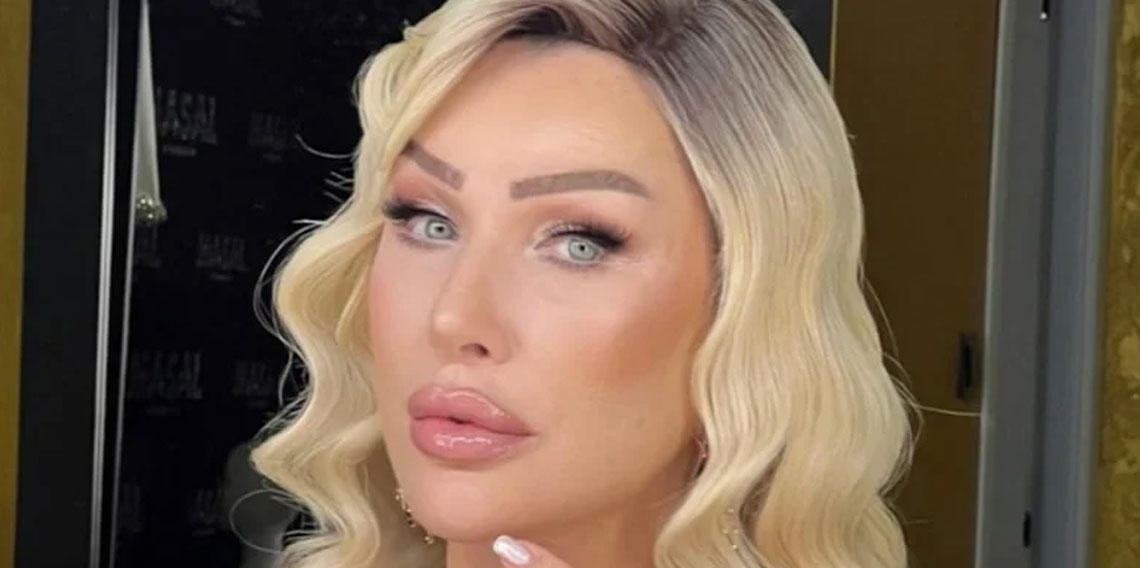 Seda Sayan yüzündeki şişliğin nedenini açıkladı