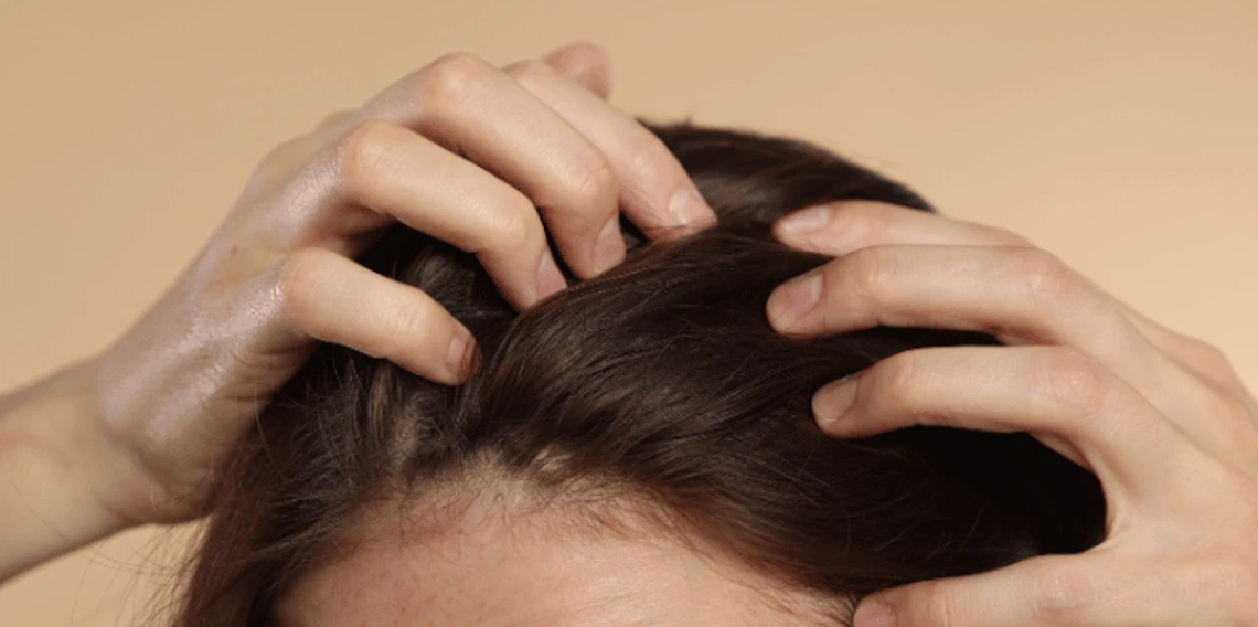 Kadınlarda saç dökülmesinin gizli nedenleri