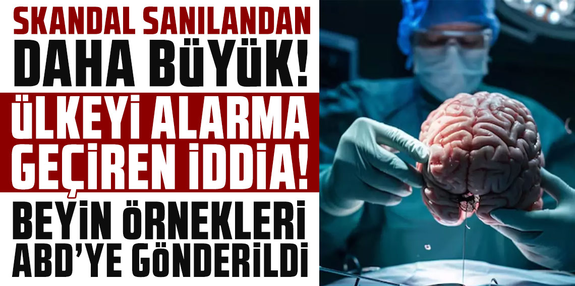 Ülkeyi alarma geçiren iddia! Beyin örnekleri ABD'ye gönderildi