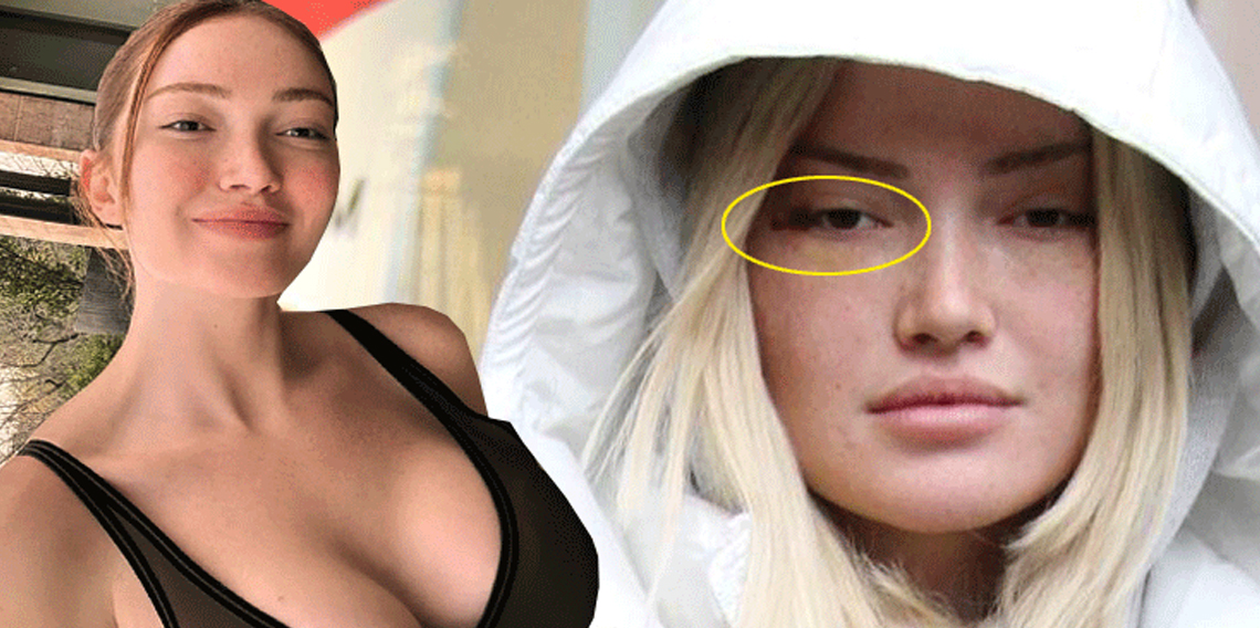 Fenomen Danla Bilic'i Darp Eden Eski Erkek Arkadaşına Mahkemeden Karar: 5 Ay Hapis