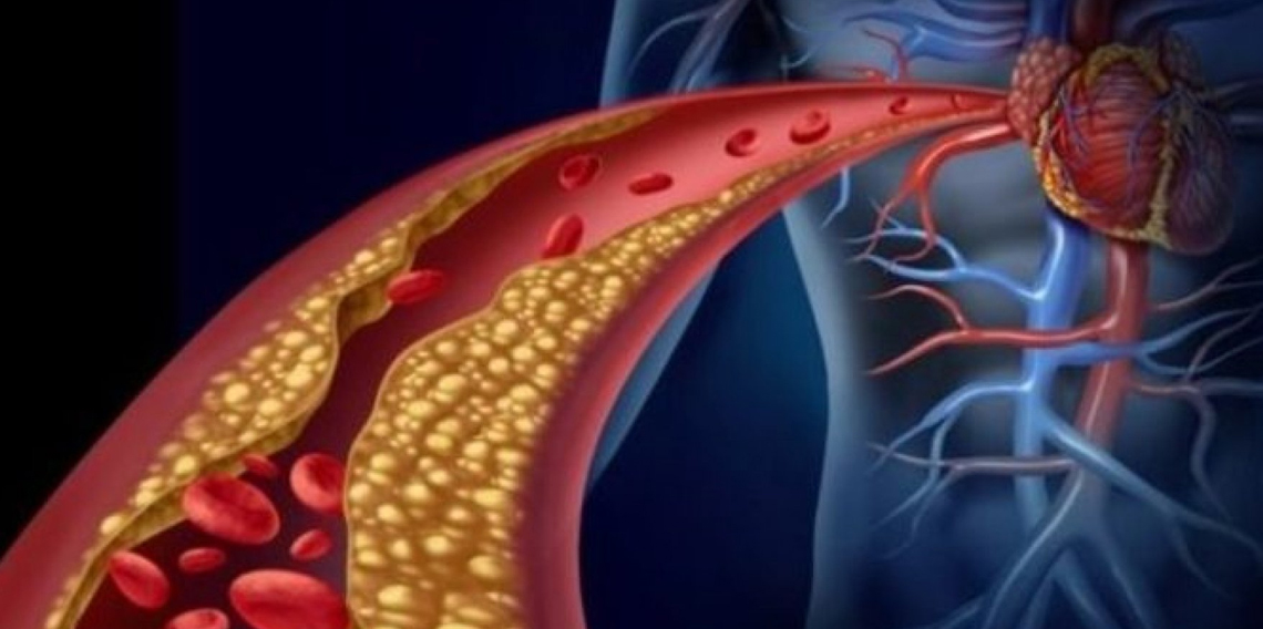 Damar Sağlığında Çığır Açacak Çalışma