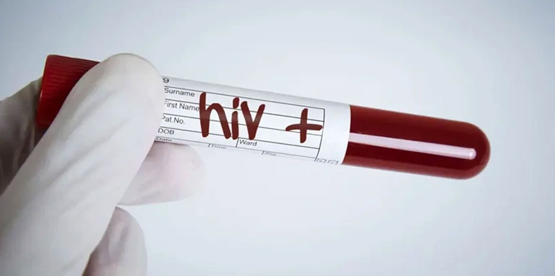 Eşinden HIV pozitif olduğunu saklayan adama hapis cezası
