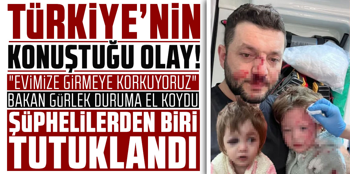 Komşuların gürültü kavgasında 14 aylık bebeğin kafatası çatladı