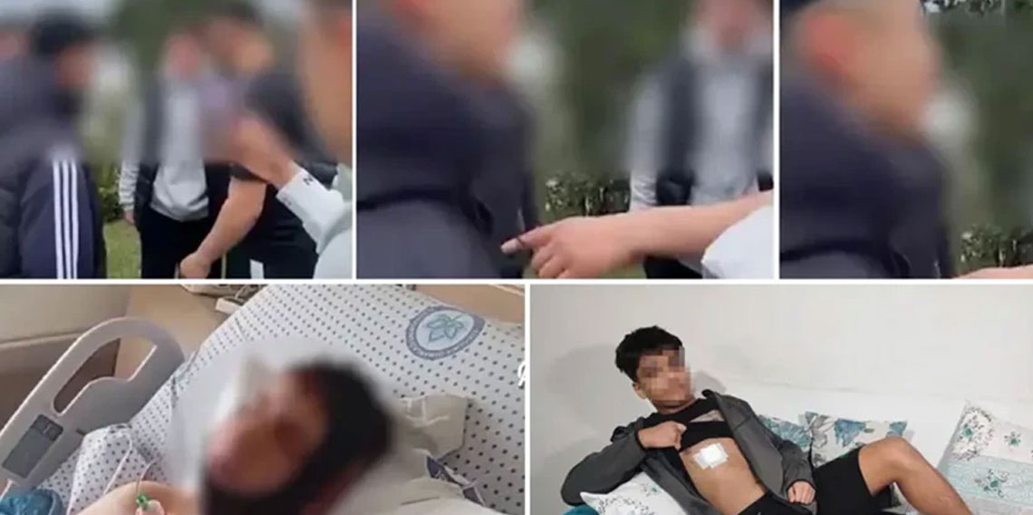 Sigara vermedi diye akranı tarafından bıçaklandı! 