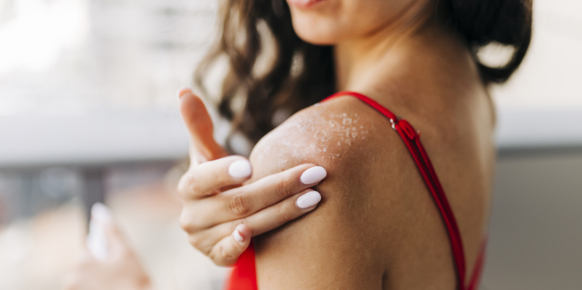 iPhone’daki “Fitzpatrick Cilt Tipi” Sorusu Ne Anlama Geliyor?