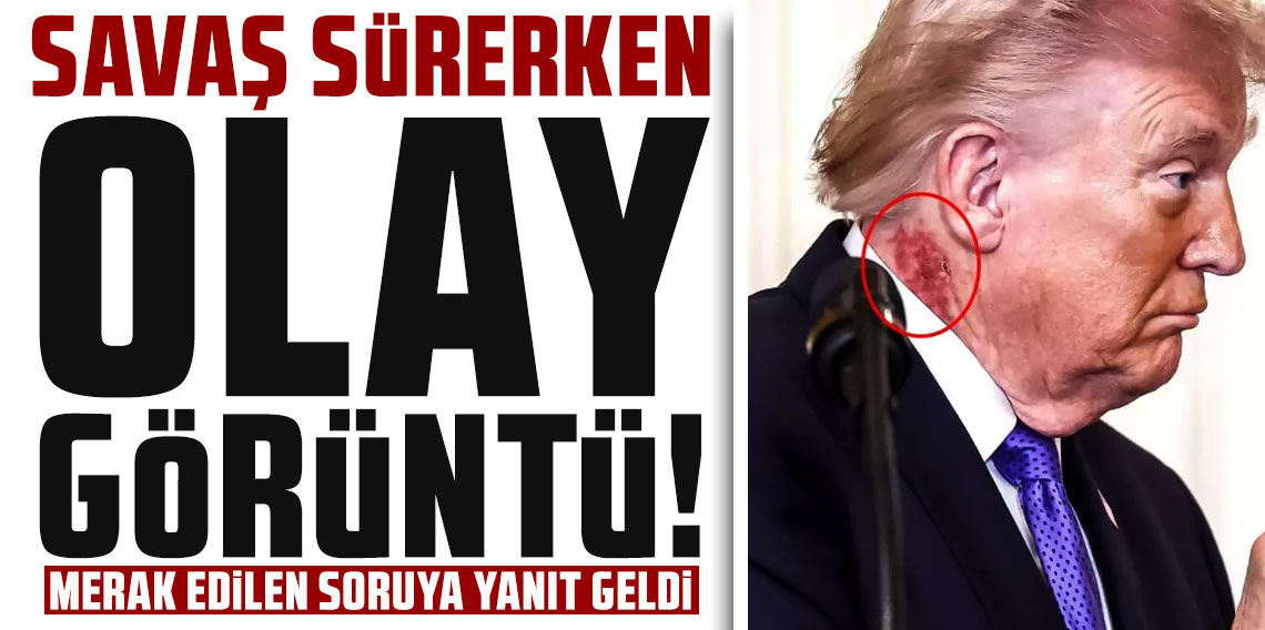 Savaş sürerken olay görüntü! Doktorundan jet açıklama geldi