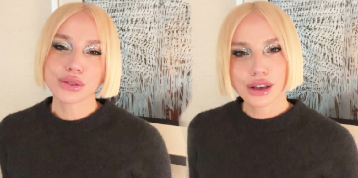 Gülşen’in Yüzündeki Değişim Sosyal Medyanın Gündeminde