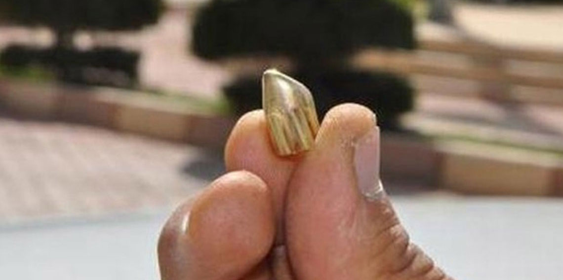 Yorgun mermi isabet eden çocuk yaralandı