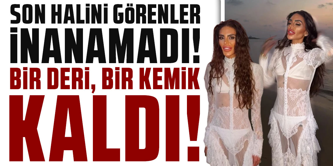 Süreyya Yalçın'ın bir deri, bir kemik kalmış son halini görenler gözlerine inanamadı