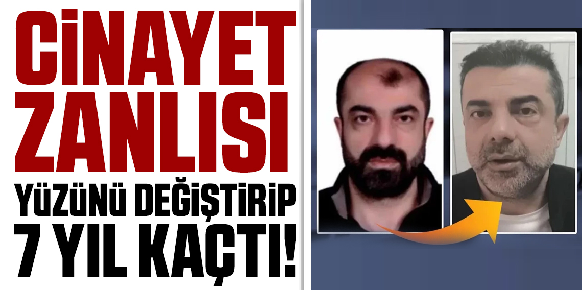 Ameliyatla yüzünü değiştirip saç ektiren cinayet zanlısı yedi yıl sonra yakalandı