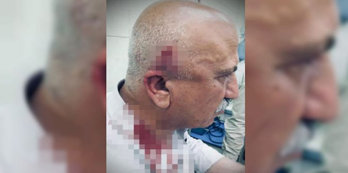 Kerkük’te kaçak yapı yıkımı sırasında kaymakama bıçaklı ve sopalı saldırı