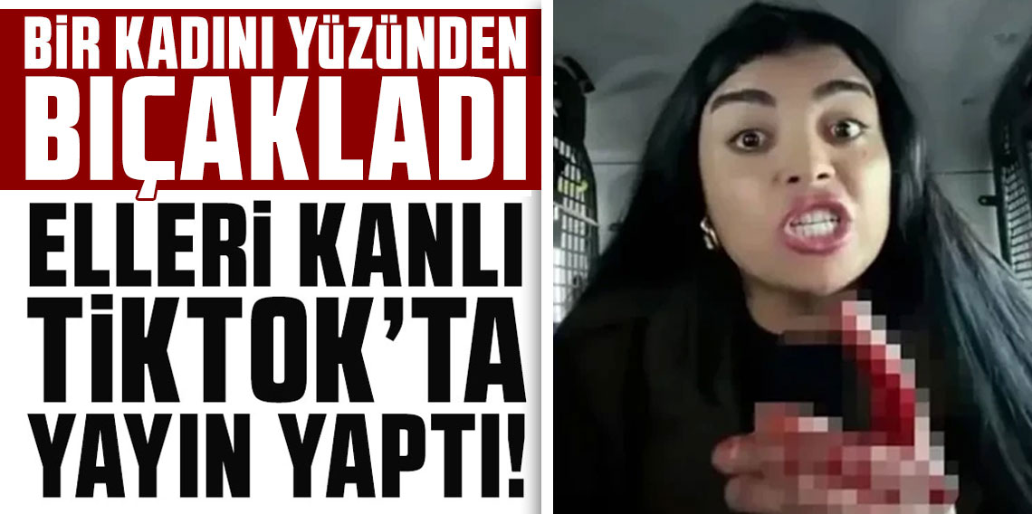 Bir kadını yüzünden bıçakladı! Elleri kanlı TikTok'ta yayın yaptı
