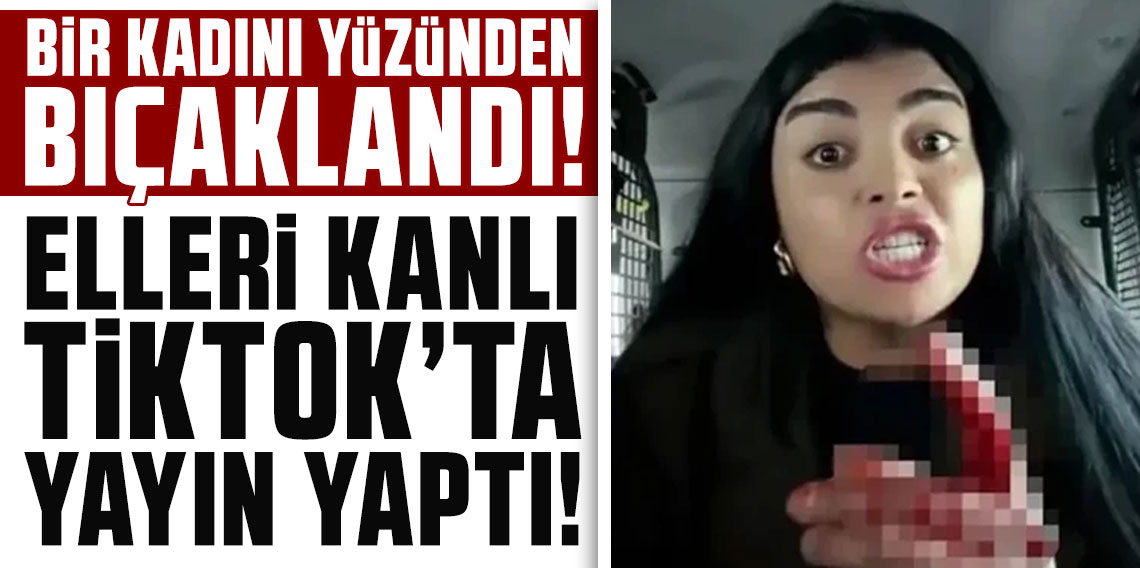 Bir kadını yüzünden bıçakladı! Elleri kanlı TikTok'ta yayın yaptı