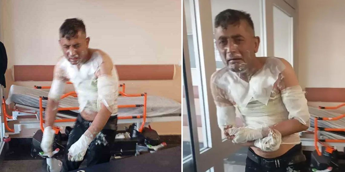 Engelli vatandaşı benzin döküp yakan vicdansıza verilen ceza belli oldu