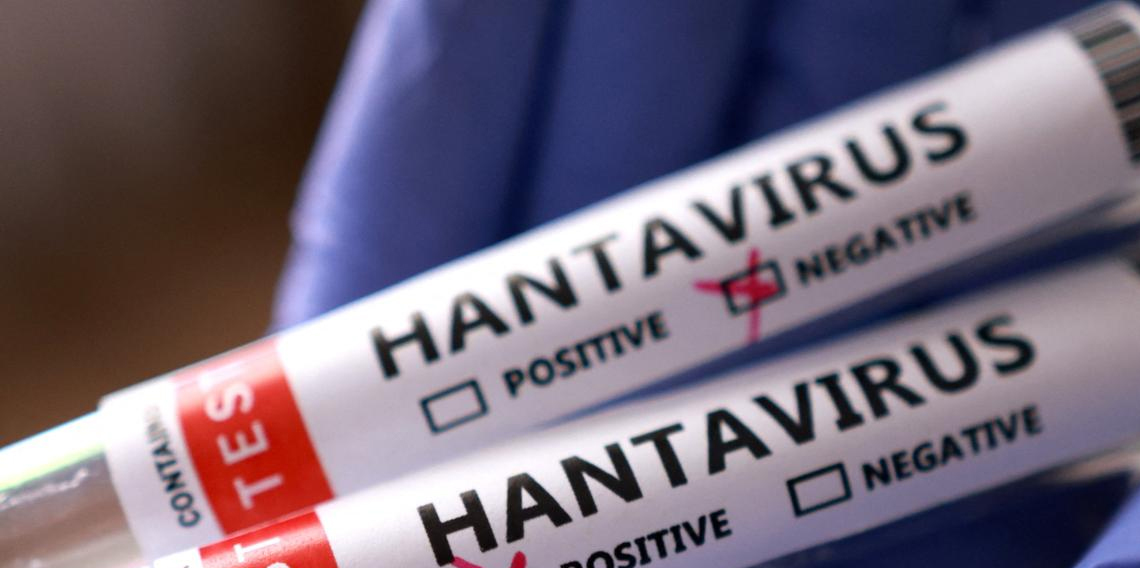 Profesörden 'Hantavirüs' uyarısı: 