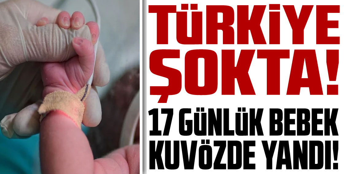 Türkiye Şokta! 17 günlük bebek kuvözde yandı