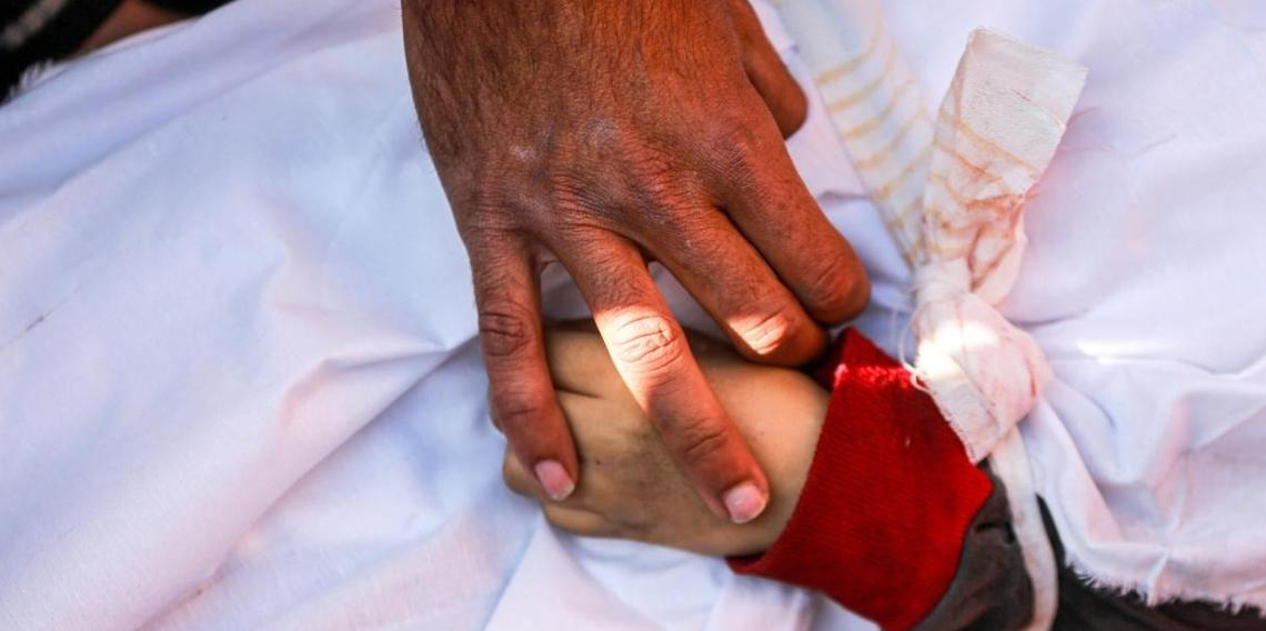 Gazze'de can kaybı 73 bin 58’e yükseldi