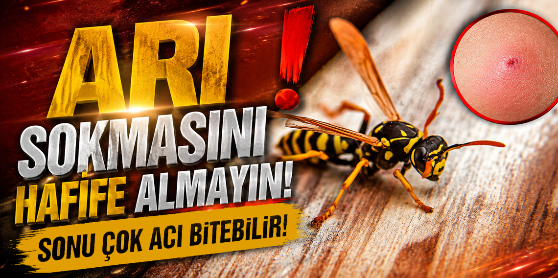 Arı Sokmasını Hafife Almayın! Sonu Ölümle Sonuçlanabilir?