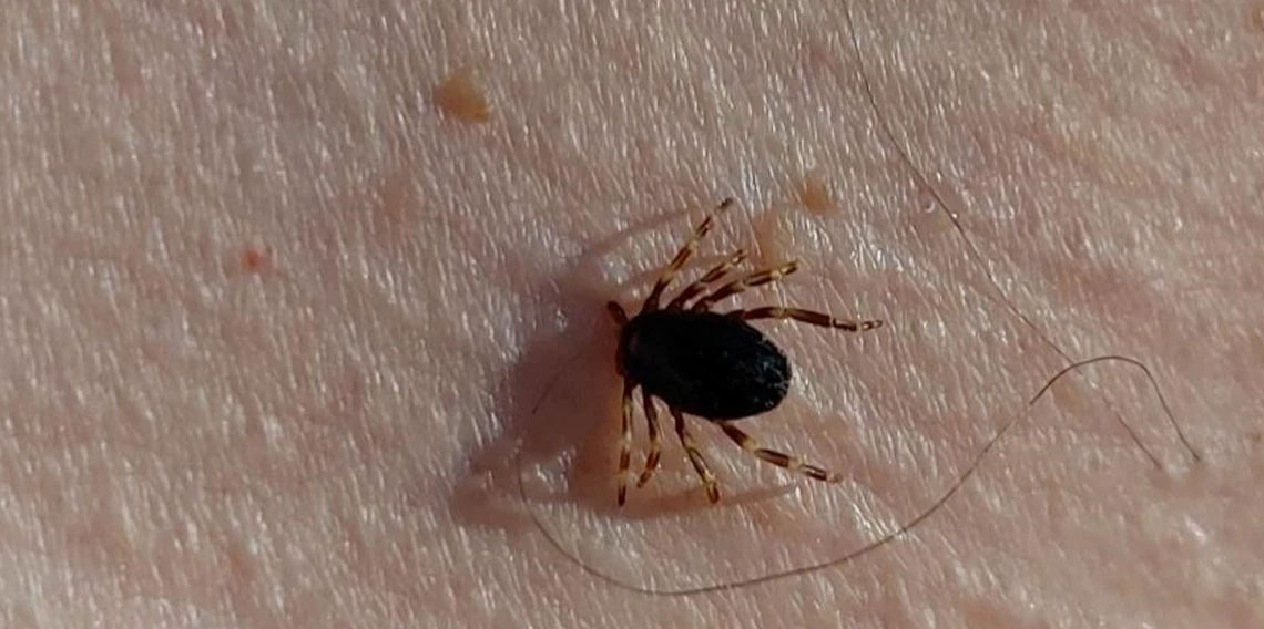 Çorum'da KKKA hastalığı tedavisi gören kişi hayatını kaybetti